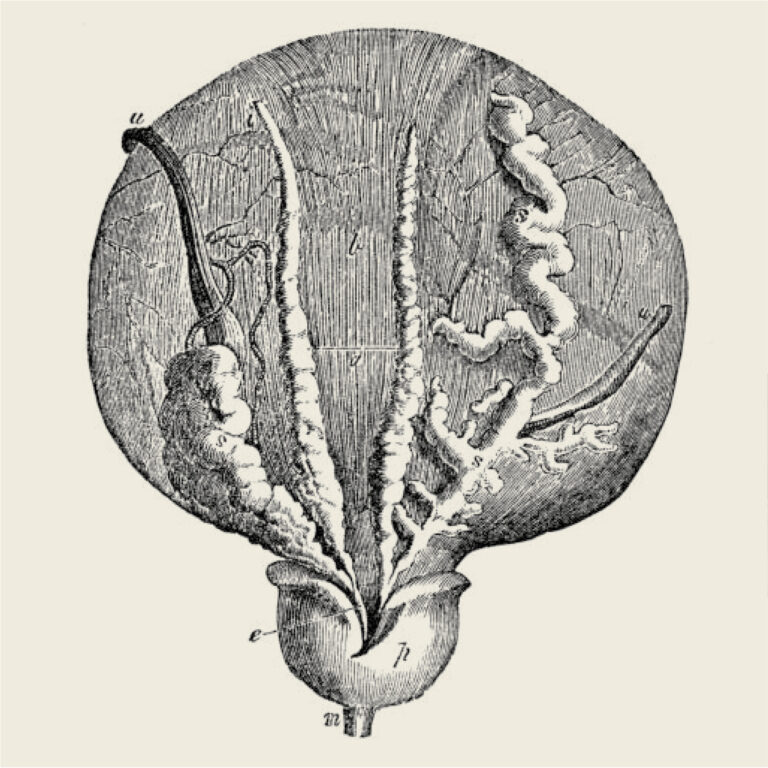 133_Die Prostata